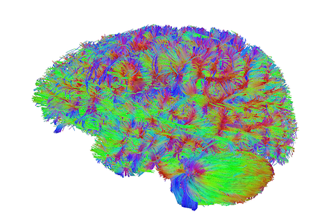 DTI Brain Image
